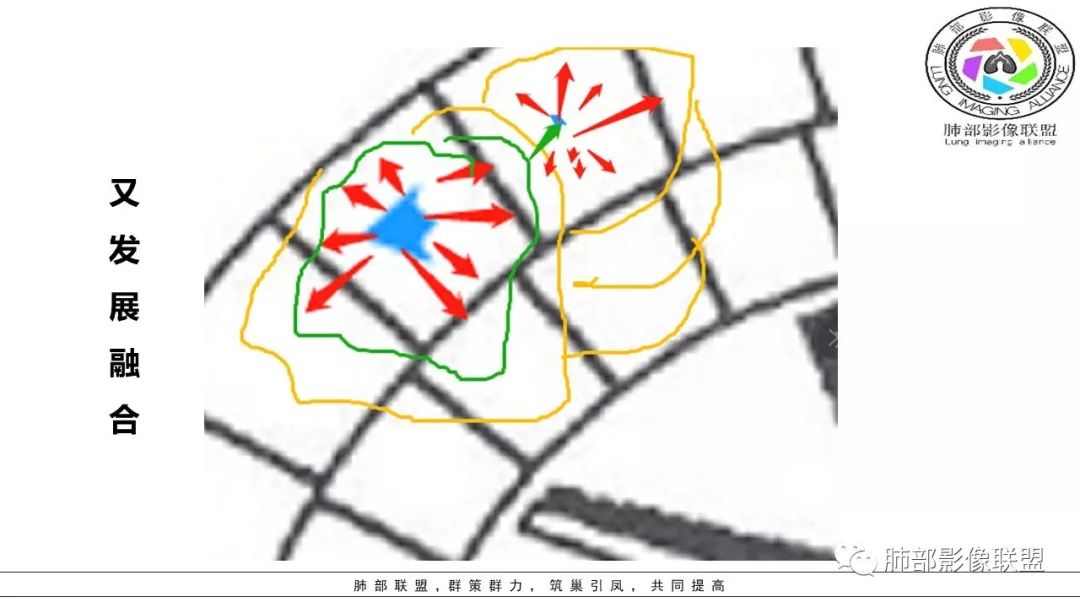 【PPT】病毒肺炎影像机制探讨