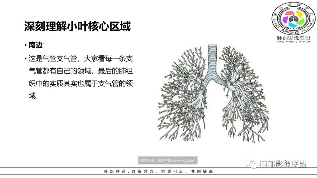 【PPT】病毒肺炎影像机制探讨