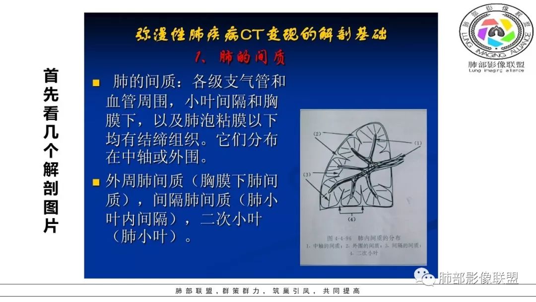 【PPT】病毒肺炎影像机制探讨