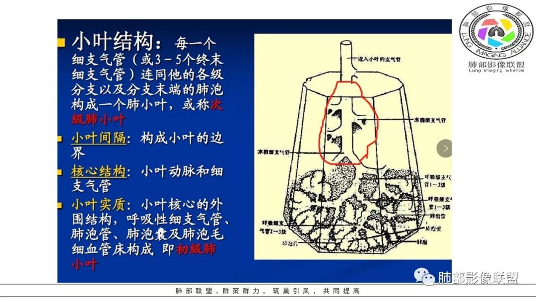 【PPT】病毒肺炎影像机制探讨