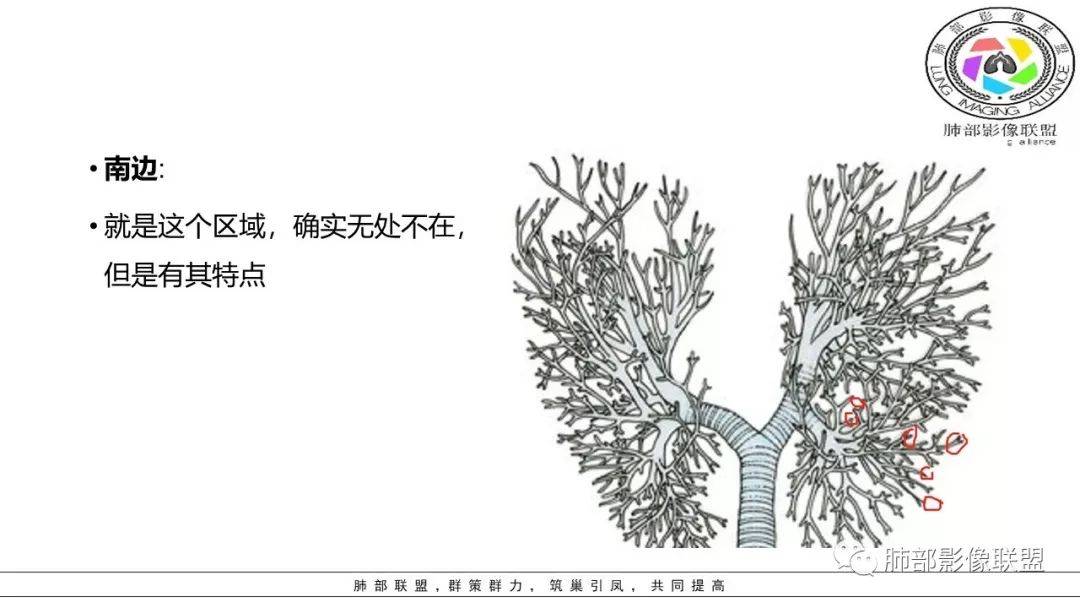【PPT】病毒肺炎影像机制探讨