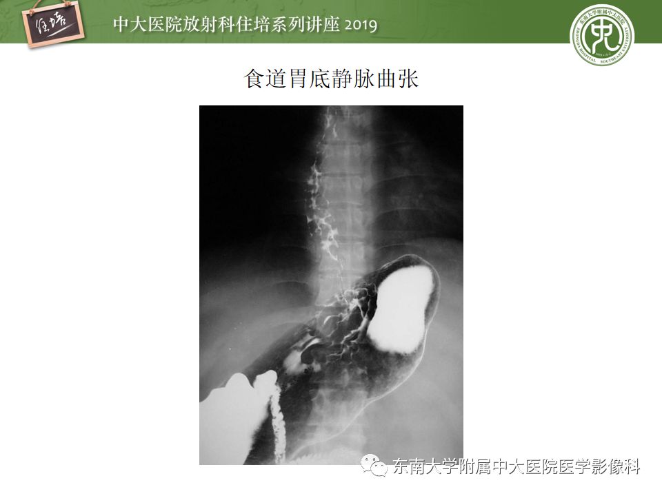 【PPT】食管常见疾病的诊断和鉴别诊断