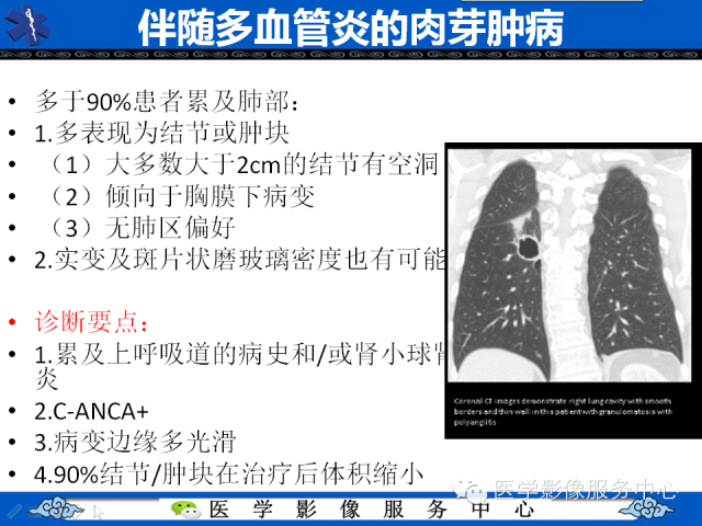 【PPT】肺癌的影像学鉴别诊断实例：哪些不是肺癌