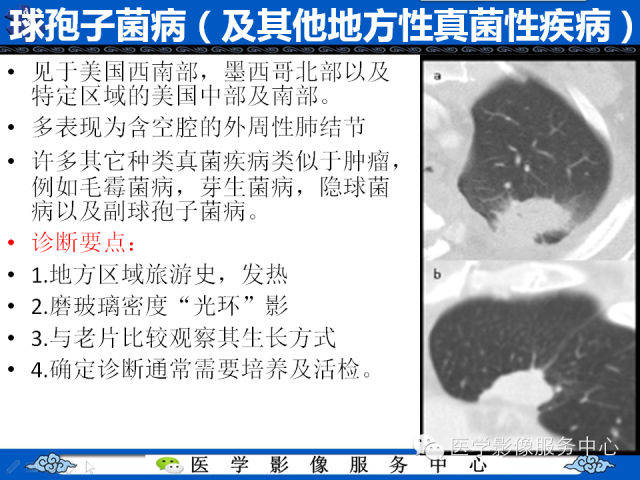 【PPT】肺癌的影像学鉴别诊断实例：哪些不是肺癌