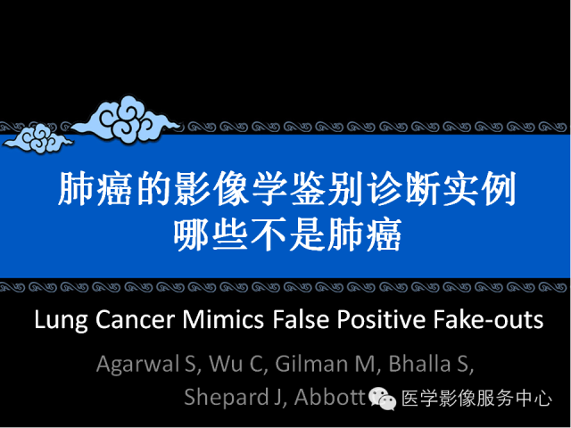 【PPT】肺癌的影像学鉴别诊断实例：哪些不是肺癌