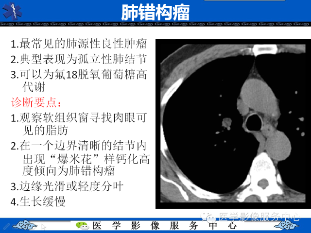 【PPT】肺癌的影像学鉴别诊断实例：哪些不是肺癌