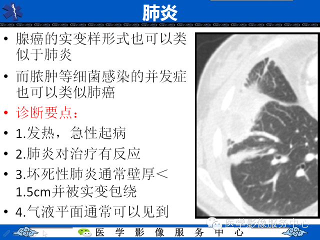 【PPT】肺癌的影像学鉴别诊断实例：哪些不是肺癌