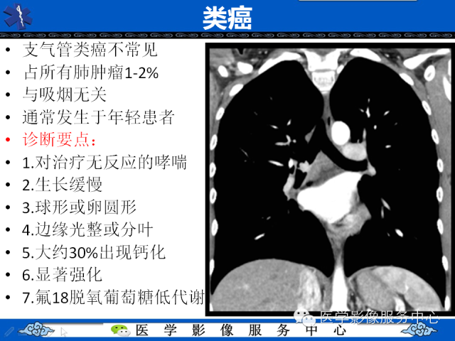 【PPT】肺癌的影像学鉴别诊断实例：哪些不是肺癌