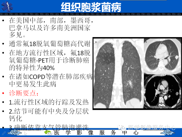 【PPT】肺癌的影像学鉴别诊断实例：哪些不是肺癌