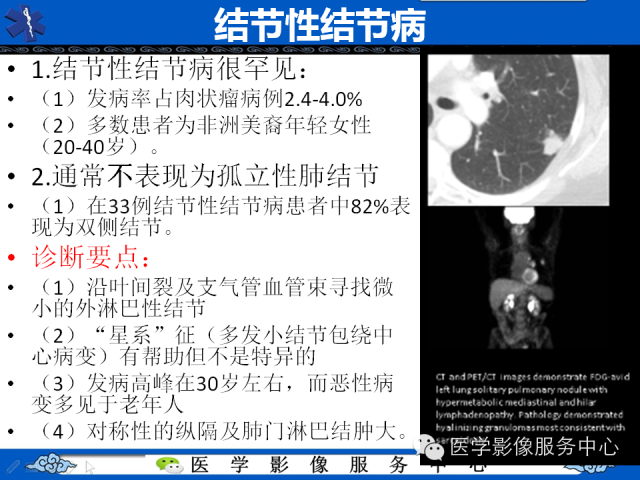 【PPT】肺癌的影像学鉴别诊断实例：哪些不是肺癌