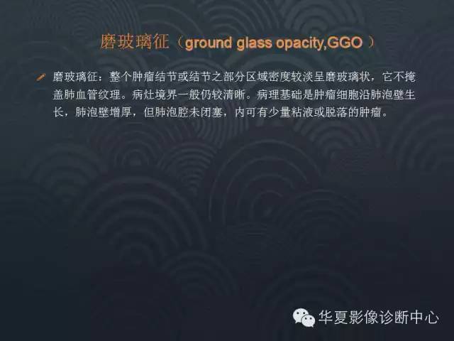 【PPT】小肺癌的影像表现及鉴别诊断
