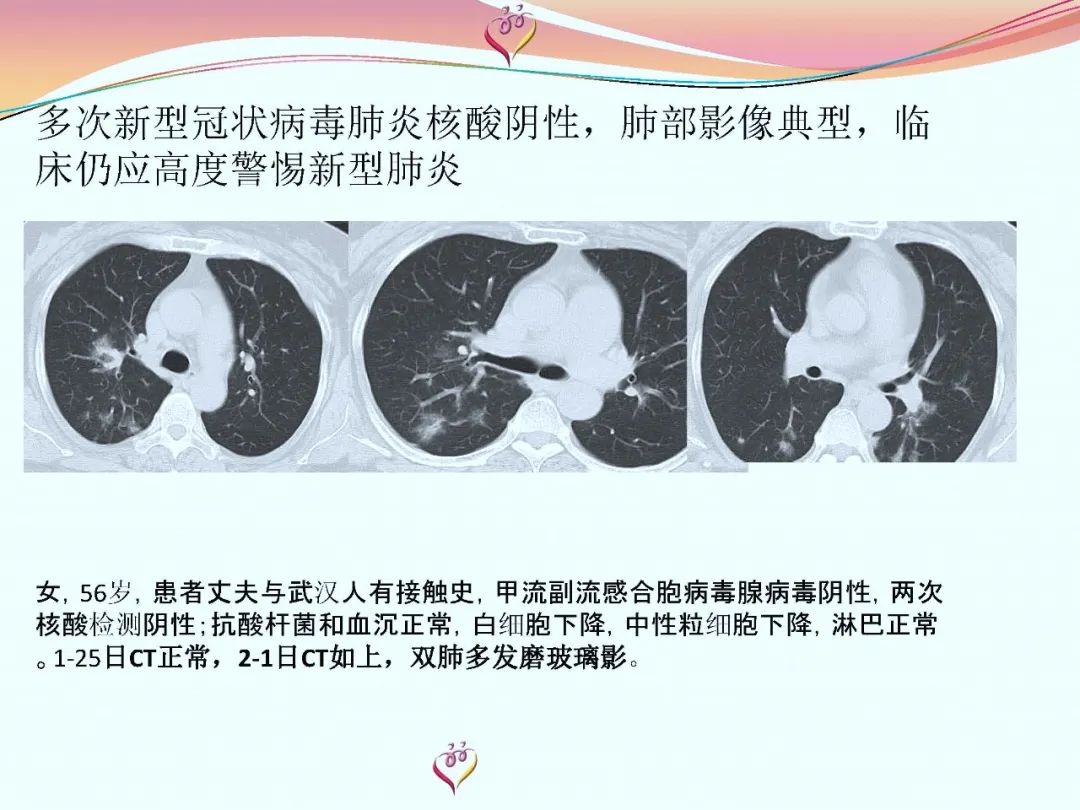 【PPT】CT室对新型冠状病毒肺炎的应对策略及影像诊断分析