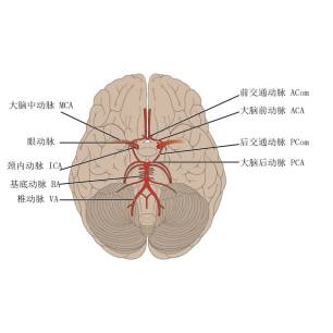 大脑Willis环的解剖及变异