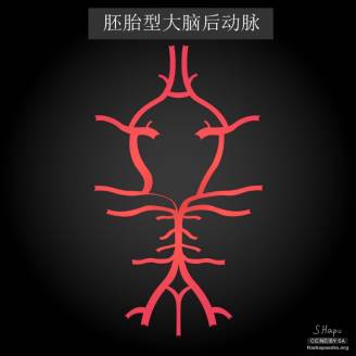 大脑Willis环的解剖及变异
