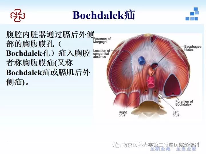 【PPT】膈肌的解剖及病变