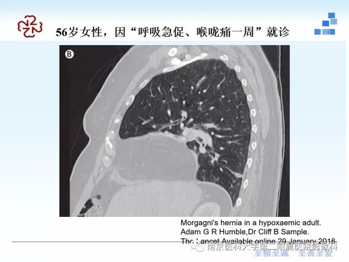 【PPT】膈肌的解剖及病变