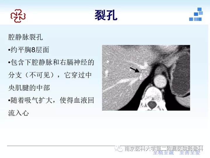 【PPT】膈肌的解剖及病变