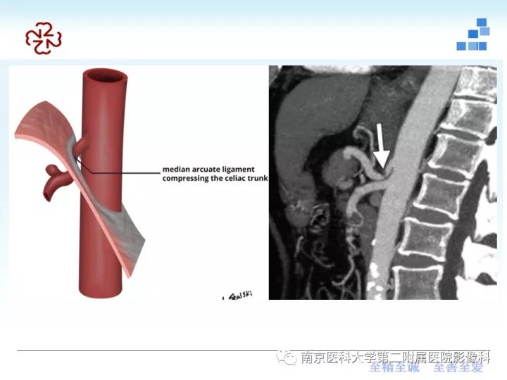 【PPT】膈肌的解剖及病变