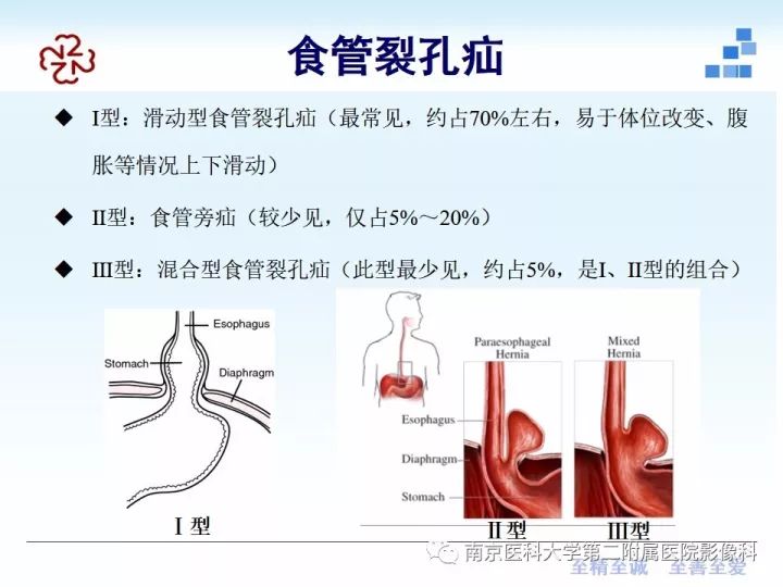 【PPT】膈肌的解剖及病变