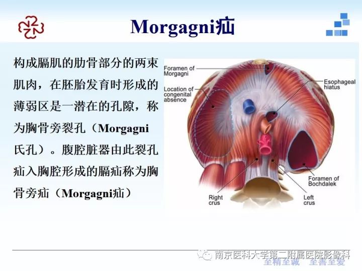 【PPT】膈肌的解剖及病变