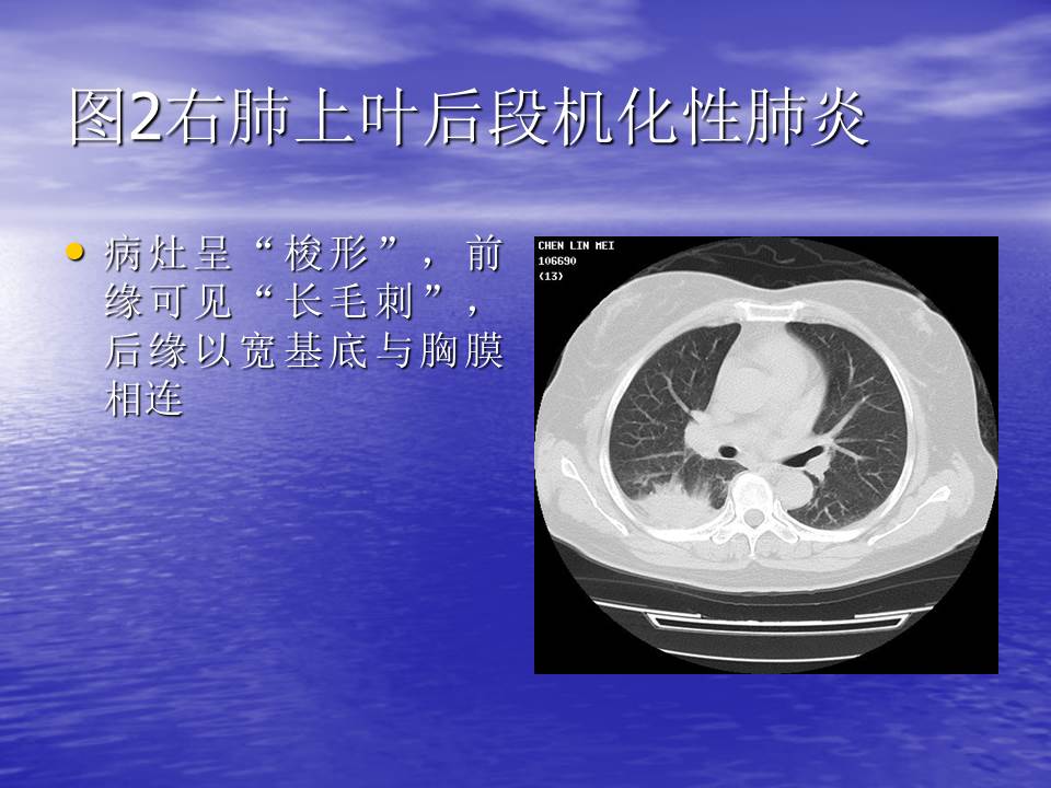 幻灯片119