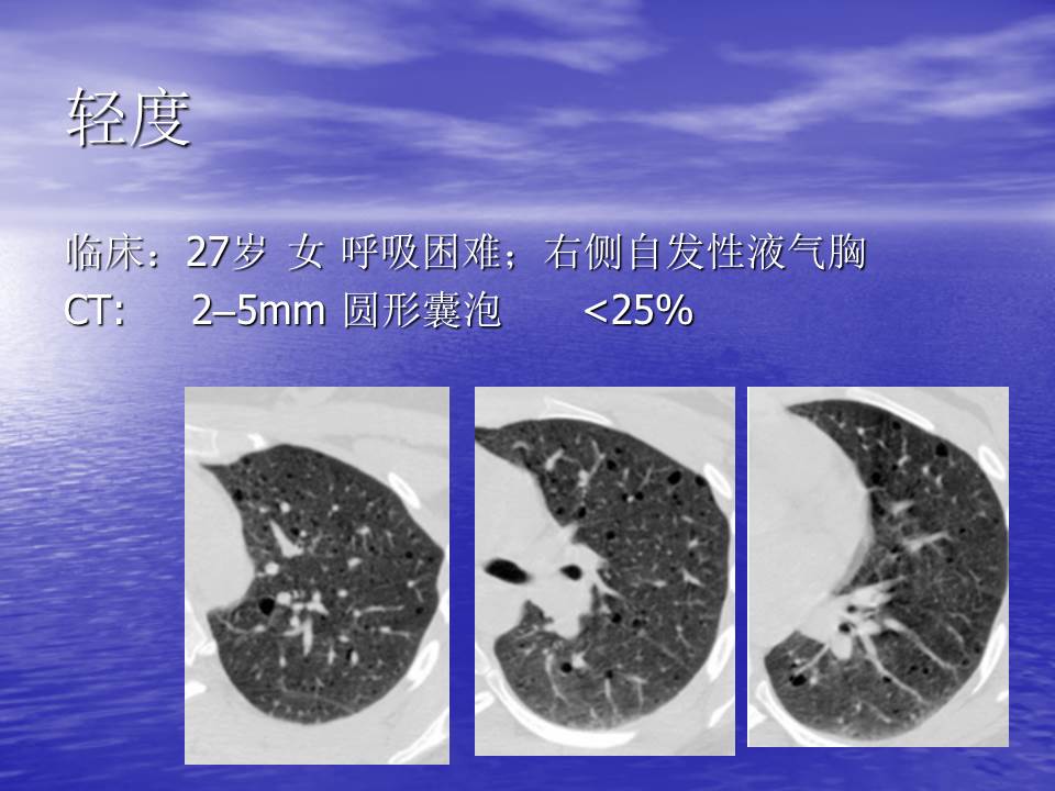 幻灯片91