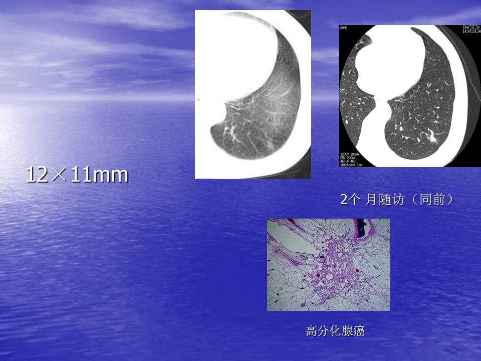 幻灯片42