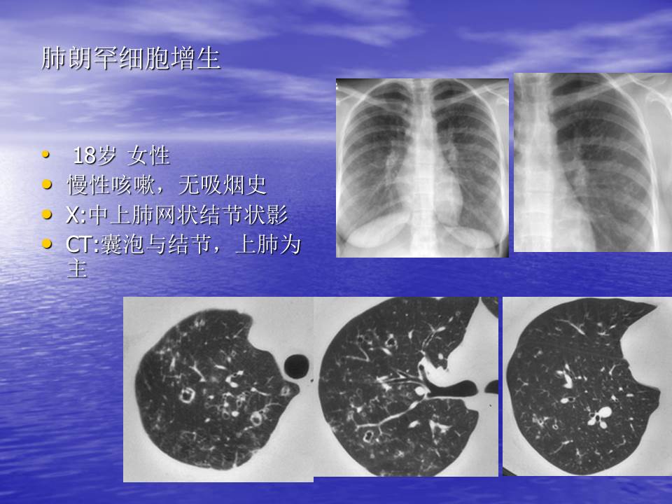 幻灯片100