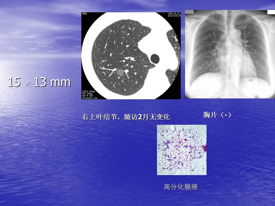 幻灯片33