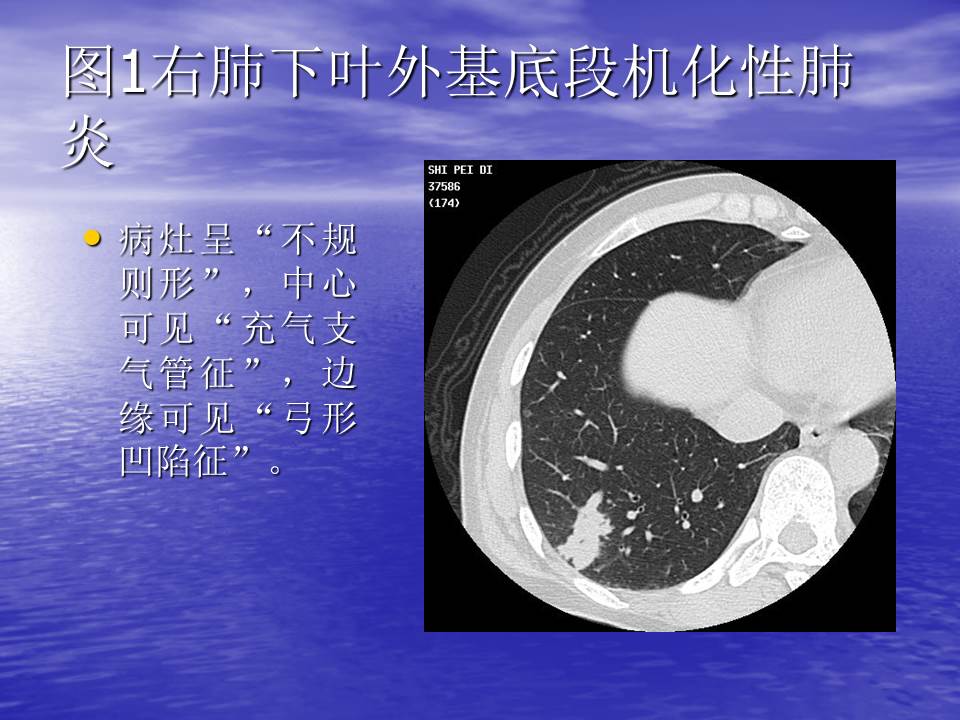 幻灯片118