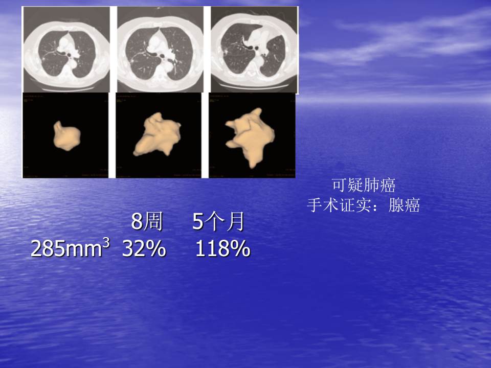 幻灯片56
