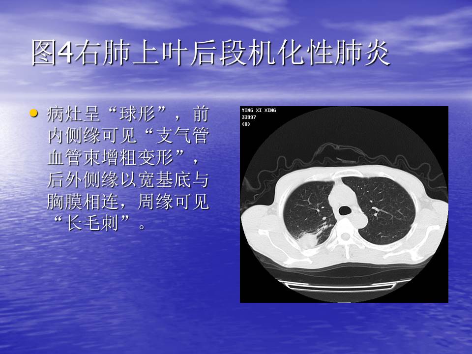 幻灯片121
