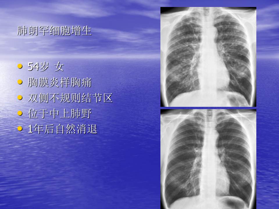 幻灯片103