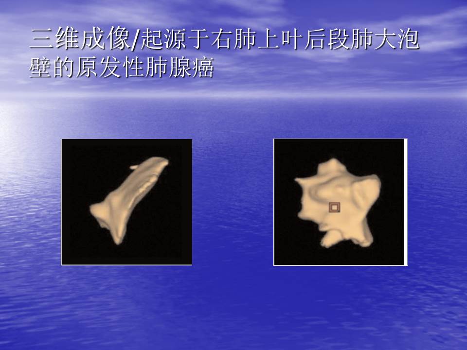 幻灯片60