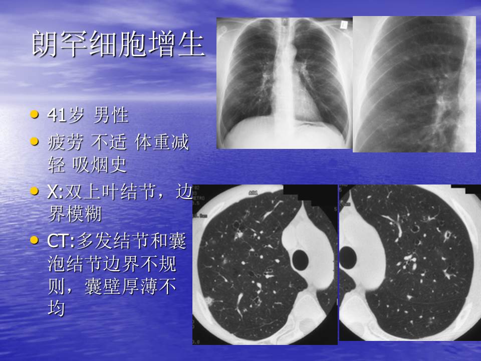 幻灯片99