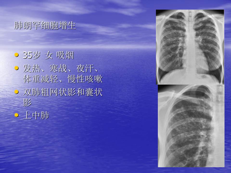 幻灯片101