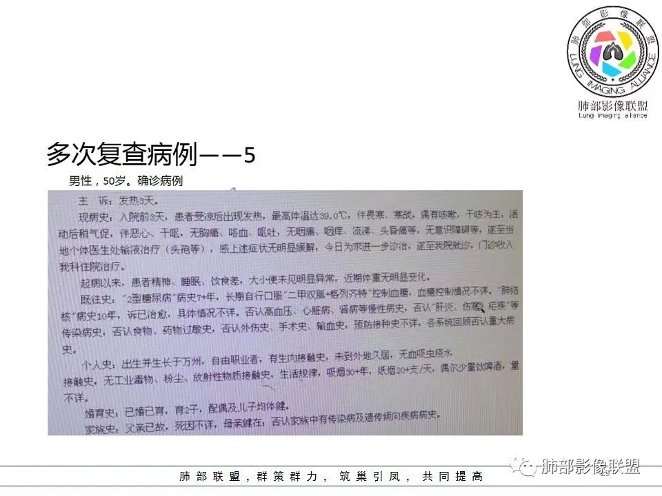 【PPT】关于180余例新冠肺炎(NCP)的影像分析与思考
