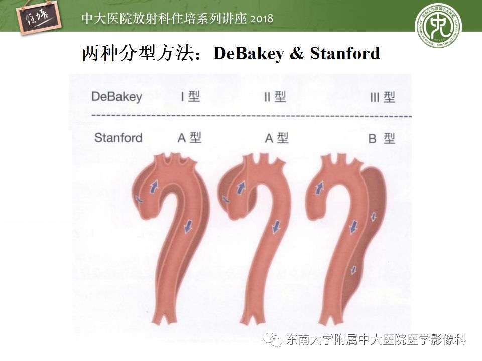 【PPT】急性主动脉综合征的CTA诊断与高风险征象