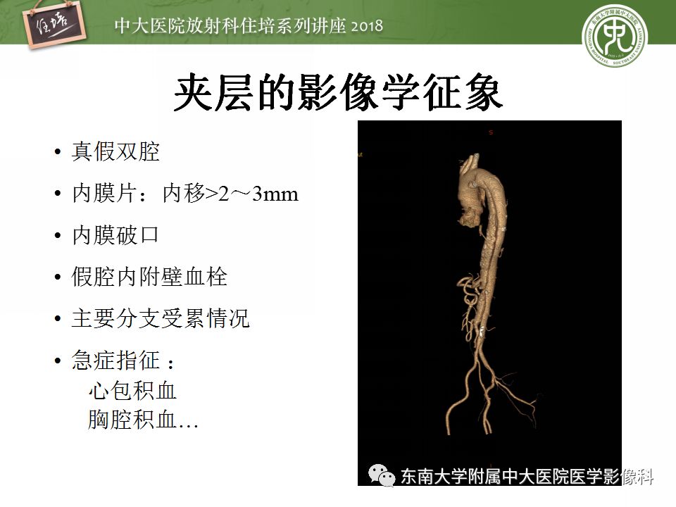 【PPT】急性主动脉综合征的CTA诊断与高风险征象