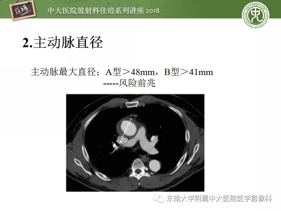 【PPT】急性主动脉综合征的CTA诊断与高风险征象