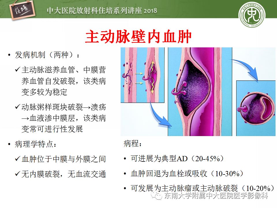 【PPT】急性主动脉综合征的CTA诊断与高风险征象