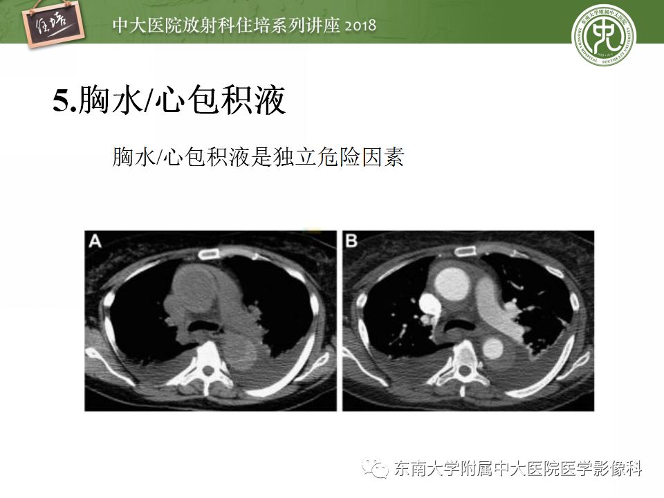 【PPT】急性主动脉综合征的CTA诊断与高风险征象