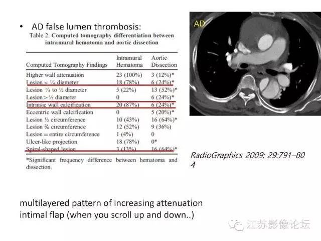 【PPT】急诊室经常遇到的急性主动脉疾病