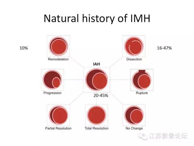 【PPT】急诊室经常遇到的急性主动脉疾病