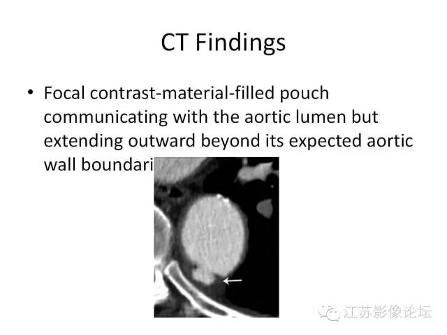 【PPT】急诊室经常遇到的急性主动脉疾病