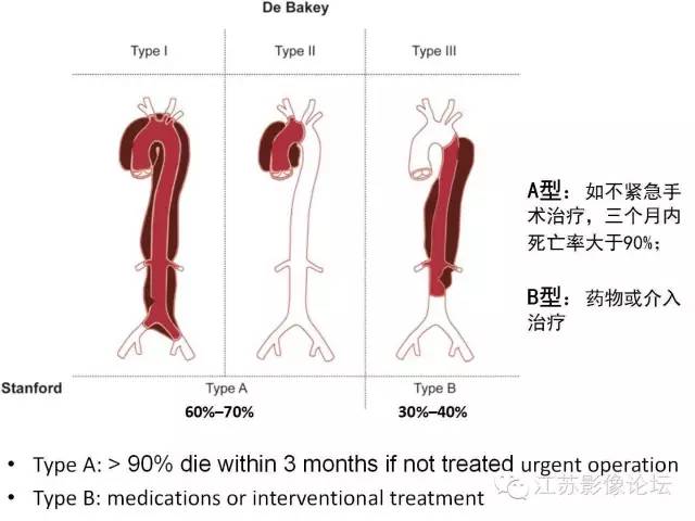 【PPT】急诊室经常遇到的急性主动脉疾病