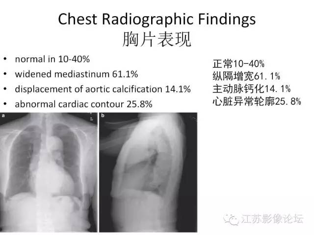 【PPT】急诊室经常遇到的急性主动脉疾病