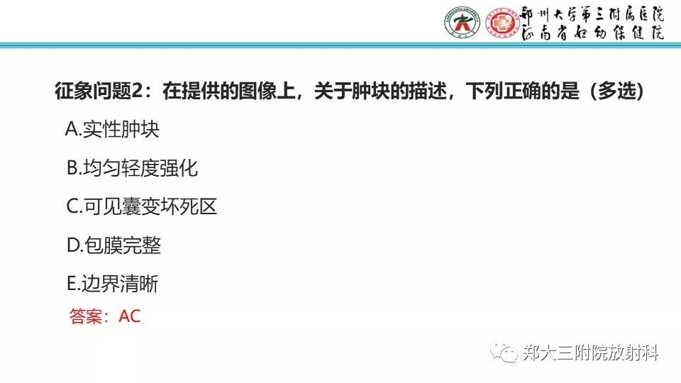 【病例】卵巢无性细胞瘤1例MR影像 【病例】卵巢无性细胞瘤1例MR影像