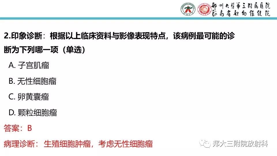 【病例】卵巢无性细胞瘤1例MR影像 【病例】卵巢无性细胞瘤1例MR影像