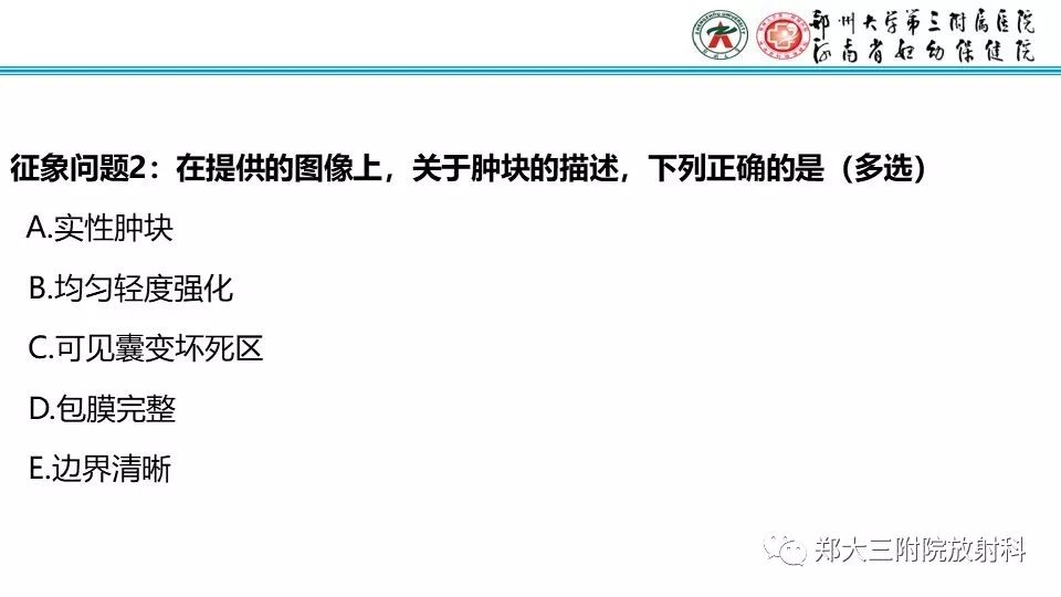 【病例】卵巢无性细胞瘤1例MR影像 【病例】卵巢无性细胞瘤1例MR影像
